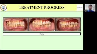 Geriadent 2024 Paper Presentation [upl. by Ji147]