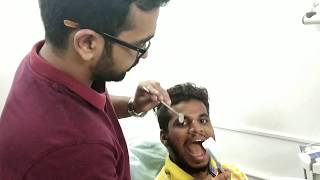 HOW TO TAKE MAXILLARY MOLAR X RAY [upl. by Wetzel868]