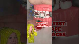 FOODS YOU CANT EAT WITH BRACES 👀 ORTHODONTIST REACTS CRUNCHY OREOS TWIX CANDY FOOD ASMR shorts [upl. by Opaline]