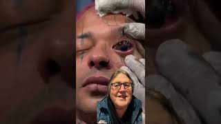 The Eyeball Sclera Tattoo  A Doctor Reacts [upl. by Llerraf]