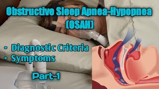 Obstructive Sleep Apnea Hypopnea  Type of Sleep Awake Disorder  DSM5  Part1  UrduHindi [upl. by Hras]