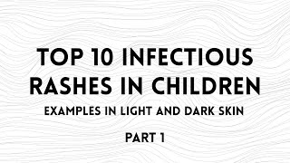 Top 10 Infectious Rashes in Children  Light and Dark Skin  Part 1 [upl. by Atteras]