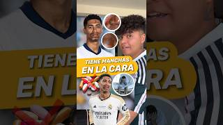 😱 ¿Que le ha pasado a Jude Bellingham Mira el video y entérate‼️ futbol shorts football soccer [upl. by Aliban]