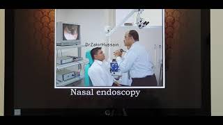 Nasal turbinate hypertrophy Part 1 English Patient teaching programme [upl. by Lewellen151]