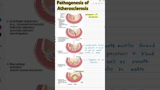 Pathogenesis of Atherosclerosispathology atherosclerosis [upl. by Boice]