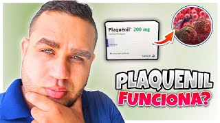 PLAQUENIL Hidroxicloroquina 200 mg PARA QUE SIRVE  EFECTOS SECUNDARIOS  EMBARAZO  LUPUS [upl. by Avid209]