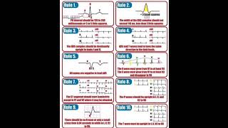 Chamberlains 10 Rules of a Normal ECG [upl. by Ruckman882]