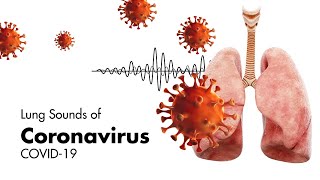 Sounds of Coronavirus COVID19  Lung Sounds [upl. by Anderson]