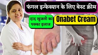 Onabet Cream  Sertaconazole Nitrate Cream 2 WW  Antifungal Cream  Onabet Cream Kis Kaam Aati Hai [upl. by Norene]