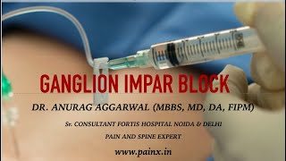 GANGLION IMPAR BLOCK [upl. by Tyoh]