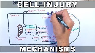 Mechanisms of Cell Injury [upl. by Mommy117]