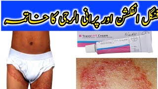 Travocort Cream Uses Benifits and Side Effects In Urdu Used For Fungnal InfectionDr Ijaz Malik [upl. by Elurd]