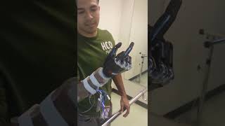 First Bionic Hand in India now Available  Bionic Arm  9773988123 Rehabmitra [upl. by Neile]