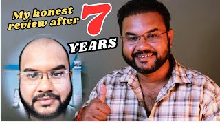 MY HAIR TRANSPLANT REVIEW AFTER 7 YEARS  HOW YOU CAN MAINTAIN YOUR LOOK LIFE LONG hairtransplant [upl. by Ailedamla]