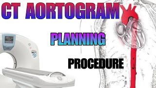 CT AORTOGRAM  planning and procedure explained [upl. by Dill71]