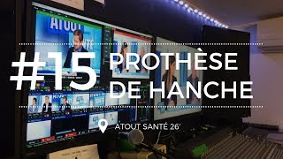 Atout Santé 15 Tout savoir sur la prothèse de la hanche [upl. by Azilem]