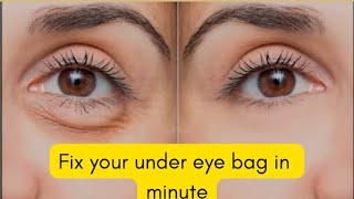 HOW TO GET RID OF PUFFY EYES  DARK UNDER EYES IN MINUTES [upl. by Karp]