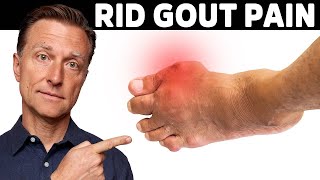 How to Cure a Gout Attack what works for me [upl. by Agustin647]