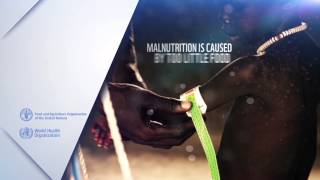 What is malnutrition [upl. by Nelyk860]