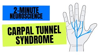 2Minute Neuroscience Carpal Tunnel Syndrome [upl. by Atworth702]