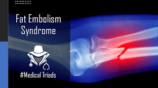 Fat Embolism Syndrome FES  Shorts MedicalTriads [upl. by Grethel]