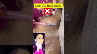 🔥Removed Facial Hair At Home EasilyPermanent Upper LipsampFacial Hair Removalshortsviral ytshorts [upl. by Oigolue480]