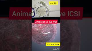 Animation vs live ICSI Procedure Intracytoplasmic sperm injection in IVF ivfinfertility ivfprocess [upl. by Godderd26]