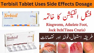 Terbisil Tablet Uses In Urdu  Terbisil Tablet 250 Mg  Terbisil 125 Mg Tablets [upl. by Filbert922]