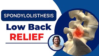 Spondylolisthesis Back Pain Relief Exercises and Adjustments [upl. by Aiasi848]