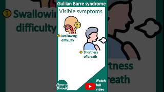 Guillain–Barré syndrome  Acute inflammatory demyelinating polyneuropathy AIDP  Pathology USMLE [upl. by Ecirp]