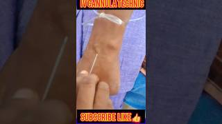 IV Cannula lagana sikhe 🏥😱🔥🩸💉doctor mbbsmotivation trending ytshorts viralshorts 😱 [upl. by Kulseth276]