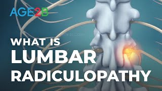 What Is Lumbar Radiculopathy  Lumbar Nerve Roots  Disc Bulge [upl. by Aivitnahs]