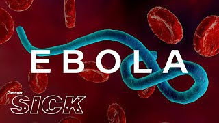 What Ebola Does to the Body [upl. by Scrivenor587]