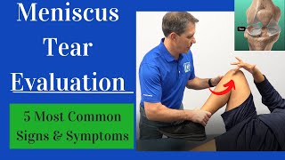 Meniscus Tear Evaluation 5 Most Common Signs and Symptoms [upl. by Nedarb673]