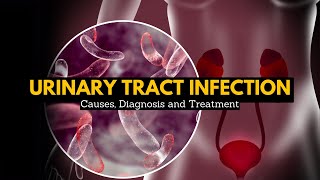 Urinary Tract Infection Causes Signs and Symptoms Diagnosis and Treatment [upl. by Santoro608]