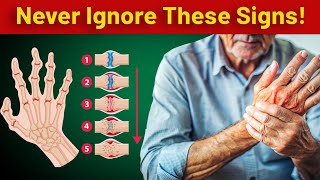 Early Arthritis Symptoms You Should Catch Before It’s Too Late arthritis arthritissymptoms [upl. by Gerdi]