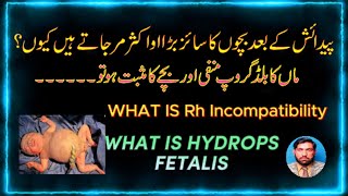 What is Hydrops Fetalis ماں کا بلڈ گروپ منفی ہو اور بچے کا مثبت ہو تو بچے پر کیا اثرات ہوتے ہیں۔ [upl. by Weissman877]