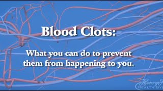 Blood Clot Prevention What You Need to Know About Deep Vein Thrombosis and Pulmonary Embolism [upl. by Ettelliw]