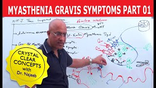 Myasthenia Gravis  Symptoms and Treatment  Part 1🩺 [upl. by Hsenid]