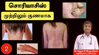 2 சொரியாசிஸ் முற்றிலும் குணமாக வழிகள்  உணவுமுறை  Psoriasis treatment  TAMIL [upl. by Ihp]