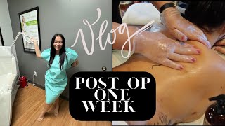 VLOG One week post op Lipo appointment [upl. by Immas]