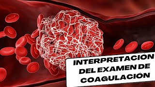 Interpretación de Pruebas de coagulación [upl. by Marna]