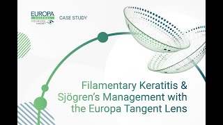 Filamentary Keratitis amp Sjögren’s Management with the Europa Tangent Lens [upl. by Ssegrub745]