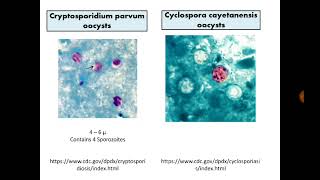 Para Findings 7 Cryptosporidium Cyclospora and Cystisospora in Stool with MZN stain [upl. by Merton]