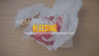 Hemorrhoid bleeding [upl. by Zinnes]