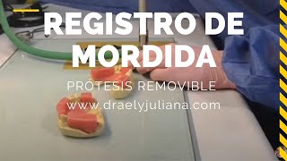 🤔 Cómo se Toma❓ el REGISTRO de MORDIDA👅 ProtesisRemovible PPR [upl. by Nodmac]