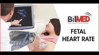 Fetal Heart Rate  Vlogs  BilMed USG Institute [upl. by Serica]