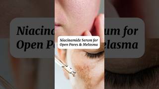 Best Niacinamide Serum  Niacinamide serum for open pores amp melasma close open pores skinregimen [upl. by Akemyt]