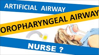 OROPHARYNGEAL AIRWAY INSERTION PROCEDURE  OPA  Artificial Airway  Oral Airway  Airway adjuncts [upl. by Hilar572]