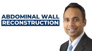 Abdominal Wall Reconstruction with Dr Tushar Patel [upl. by Okime]